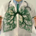 Tratamento de Pneumonia - Dra. Ana Clara Vasconcelos